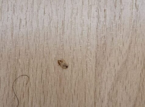 bedbug control cambridge